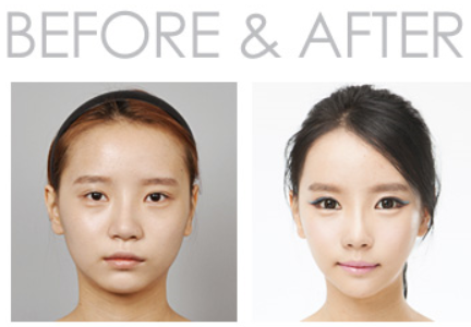 face slimming exercises before and after plastic surgery